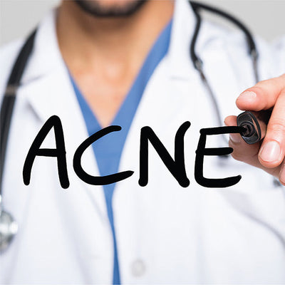 A Guide to Better Understanding Acne