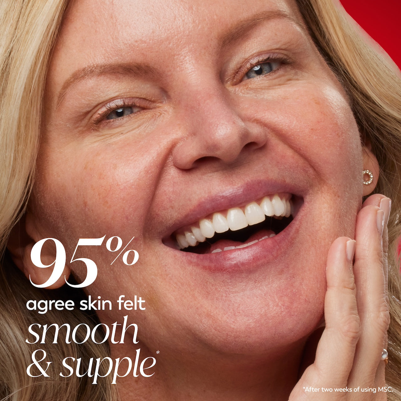 Model posing and smiling. 95% agree skin felt smooth and supple*. *After 2 weeks of using MSC Model posing and smiling. 95% agree skin felt smooth and supple*. *After 2 weeks of using MSC