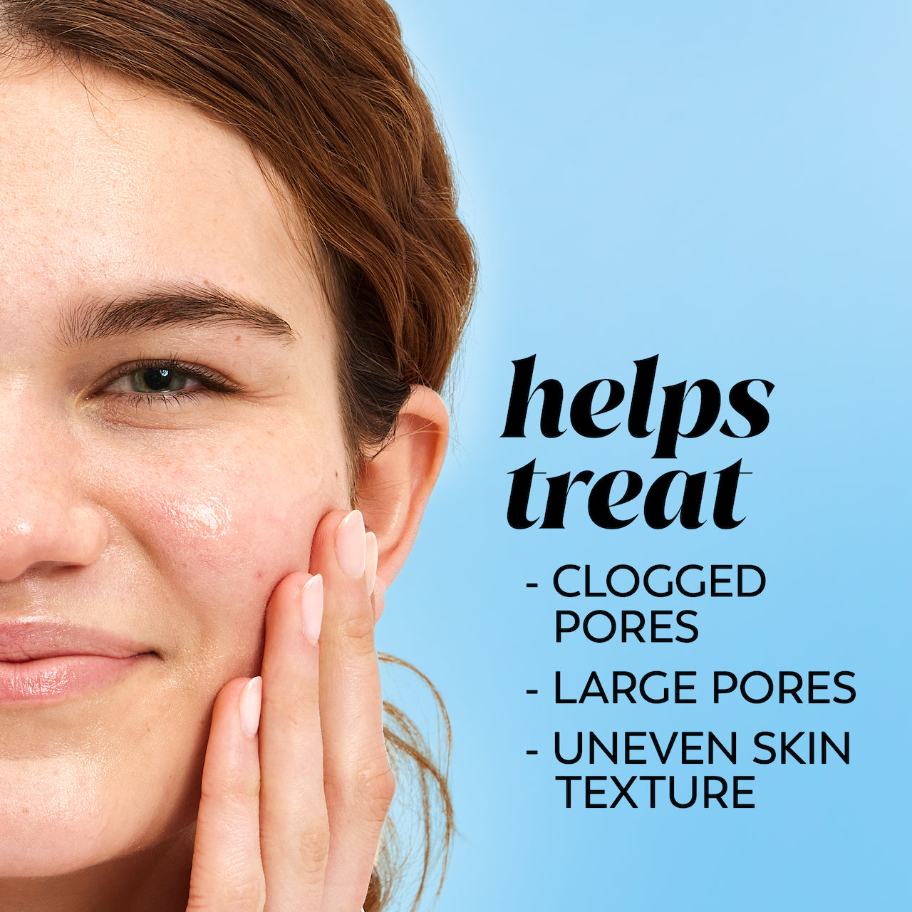 Model posing. Helps treat clogged pores, large pores, uneven skin texture Model posing. Helps treat clogged pores, large pores, uneven skin texture