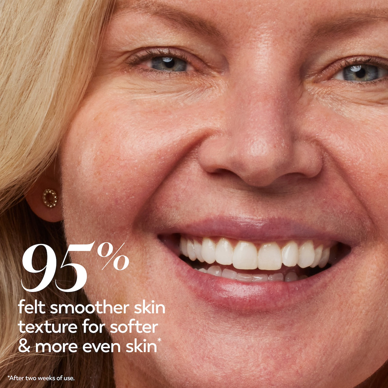 Model posing and smiling. 95% felt smoother skin texture for softer and more even skin* *after two weeks of use Model posing and smiling. 95% felt smoother skin texture for softer and more even skin* *after two weeks of use