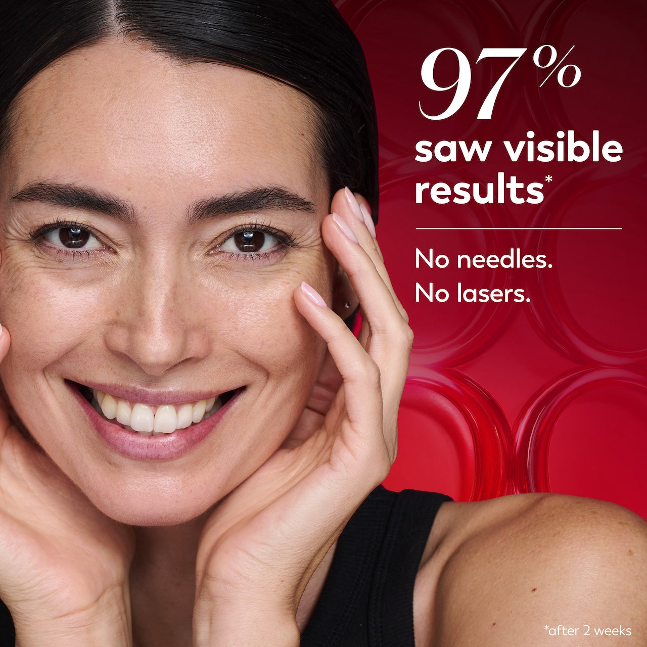 Model posing and smiling with hands on face. 97% saw visible results*. No needles, no lasers. *after 2 weeks. Model posing and smiling with hands on face. 97% saw visible results*. No needles, no lasers. *after 2 weeks.