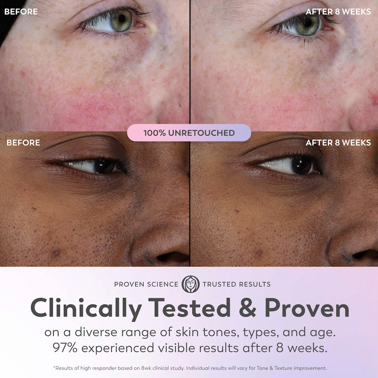4 before and after images before using Super Serum and after 8 weeks. Clinically tested and proven on a diverse range of skin tones, types and age. 97% experienced visible results after 8 weeks. *results of high responder based on 8wk clinical study. Individual results will vary for tone and texture improvement. 4 before and after images before using Super Serum and after 8 weeks. Clinically tested and proven on a diverse range of skin tones, types and age. 97% experienced visible results after 8 weeks. *results of high responder based on 8wk clinical study. Individual results will vary for tone and texture improvement.