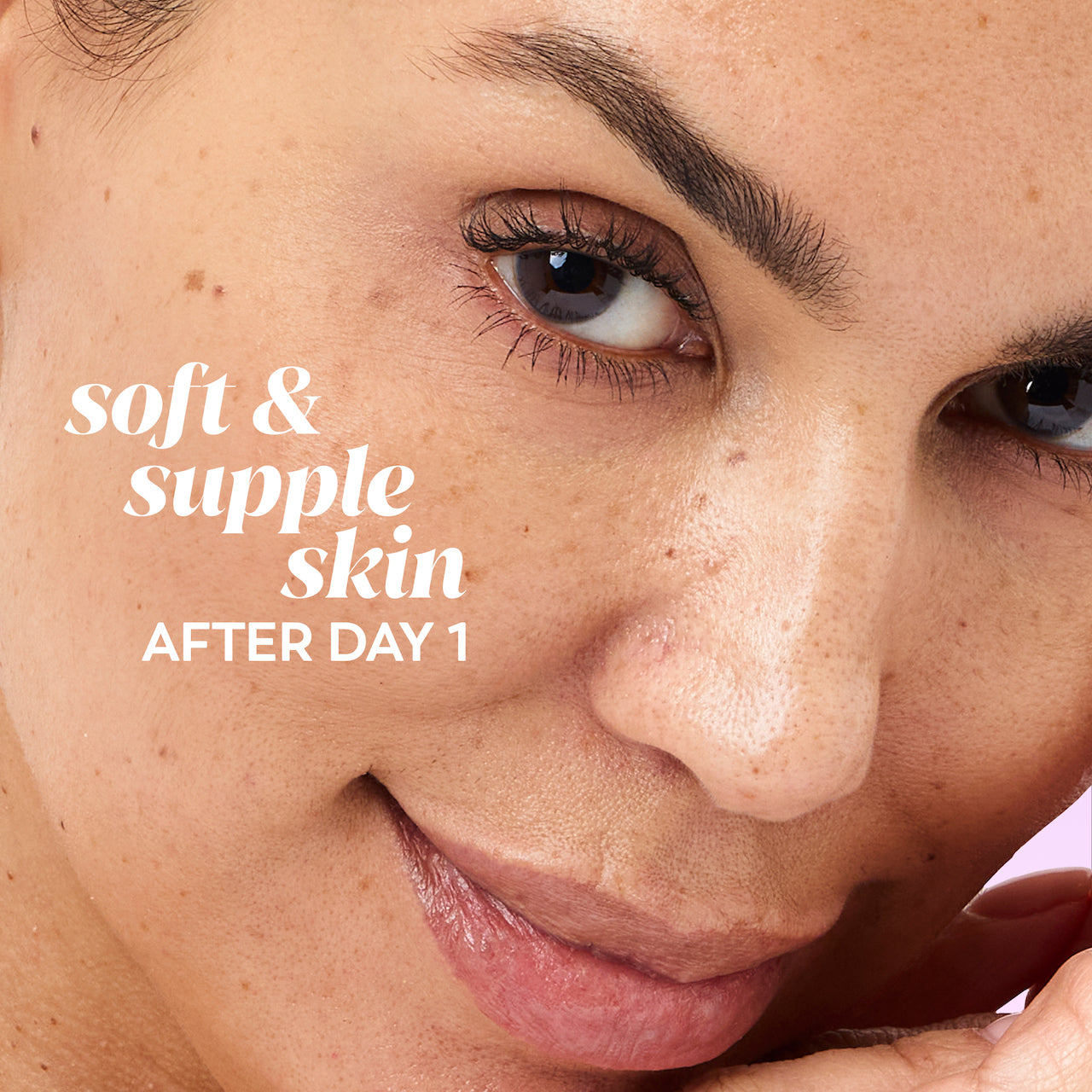 Model posing. Soft and supple skin after day 1 Model posing. Soft and supple skin after day 1