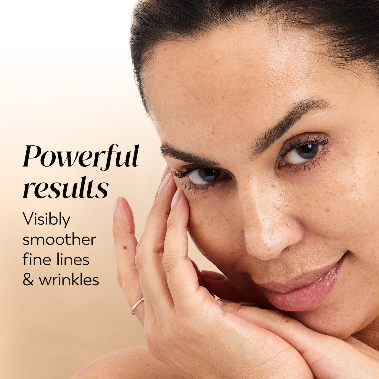 Model posing with hand on face. Powerful results. Visibly smoother fine lines and wrinkles. Model posing with hand on face. Powerful results. Visibly smoother fine lines and wrinkles.
