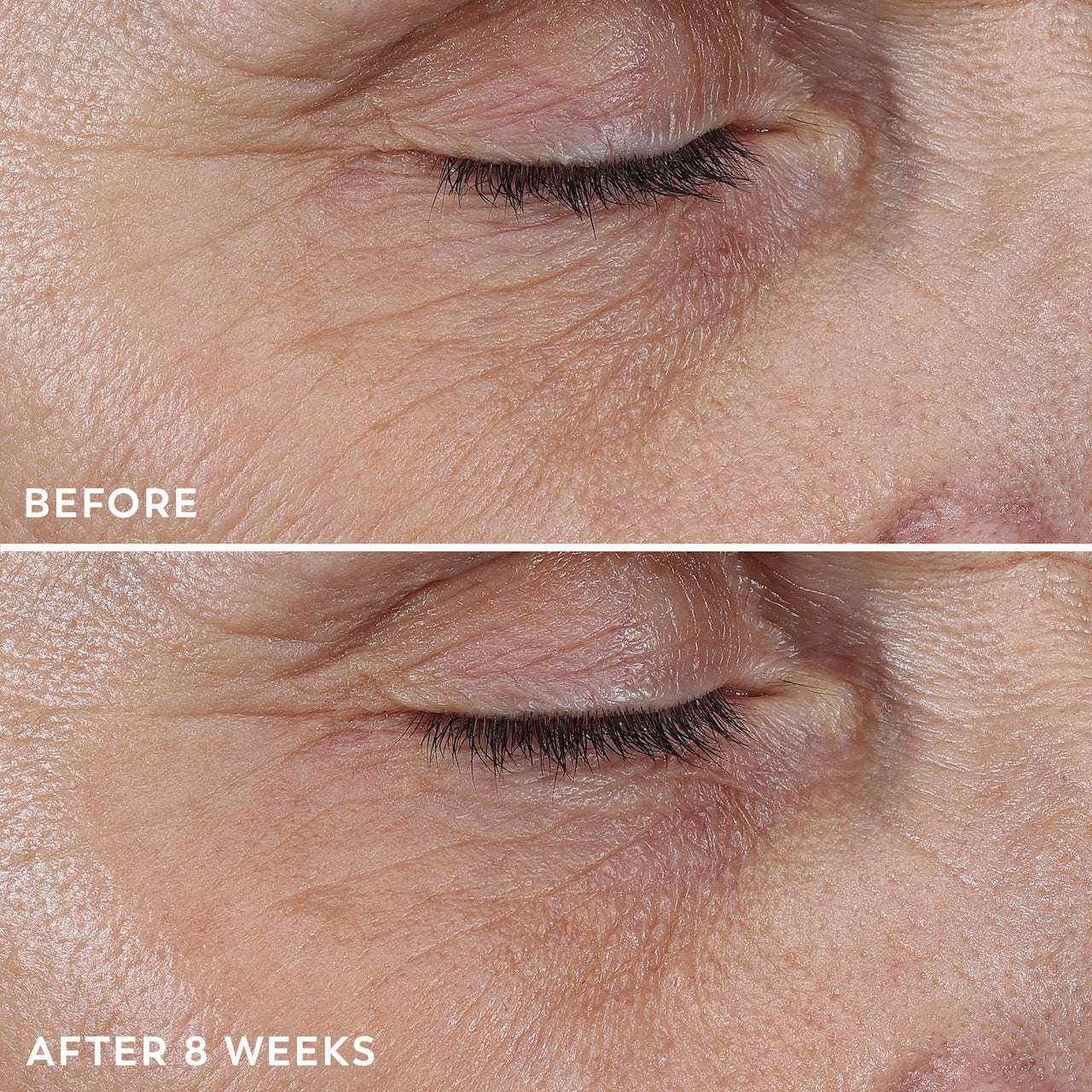 Model showing before and after 8 weeks using Regenerist Micro-Sculpting Cream Moisturizer. Model showing before and after 8 weeks using Regenerist Micro-Sculpting Cream Moisturizer.