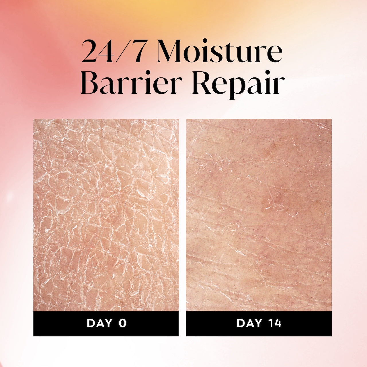 Before and after images using Olay Ultra Moisture Body Wash from day 0 to day 14. 24/7 moisture repair barrier repair Before and after images using Olay Ultra Moisture Body Wash from day 0 to day 14. 24/7 moisture repair barrier repair