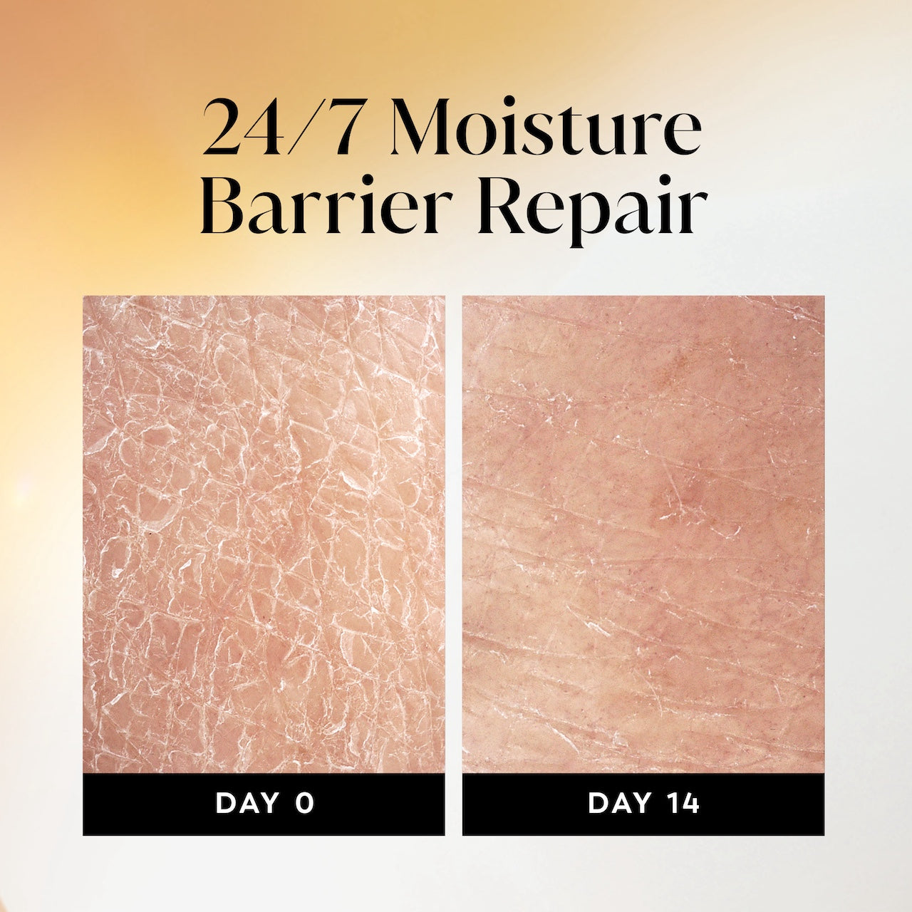 Before and after images using Olay Ultra Moisture Body Wash from day 0 to day 14. 24/7 moisture repair barrier repair Before and after images using Olay Ultra Moisture Body Wash from day 0 to day 14. 24/7 moisture repair barrier repair