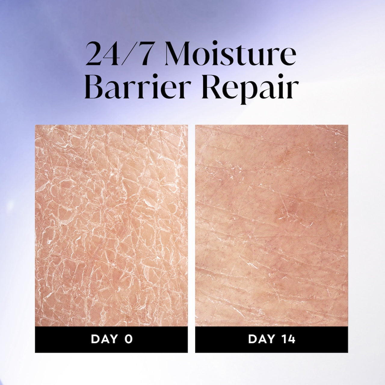 Before and after images using Olay Ultra Moisture Body Wash from day 0 to day 14. 24/7 moisture repair barrier repair Before and after images using Olay Ultra Moisture Body Wash from day 0 to day 14. 24/7 moisture repair barrier repair