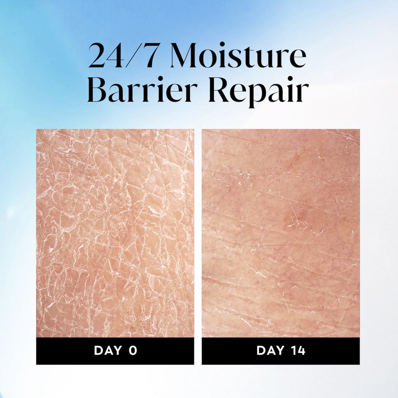 Before and after images using Olay Ultra Moisture Body Wash from day 0 to day 14. 24/7 moisture repair barrier repair Before and after images using Olay Ultra Moisture Body Wash from day 0 to day 14. 24/7 moisture repair barrier repair