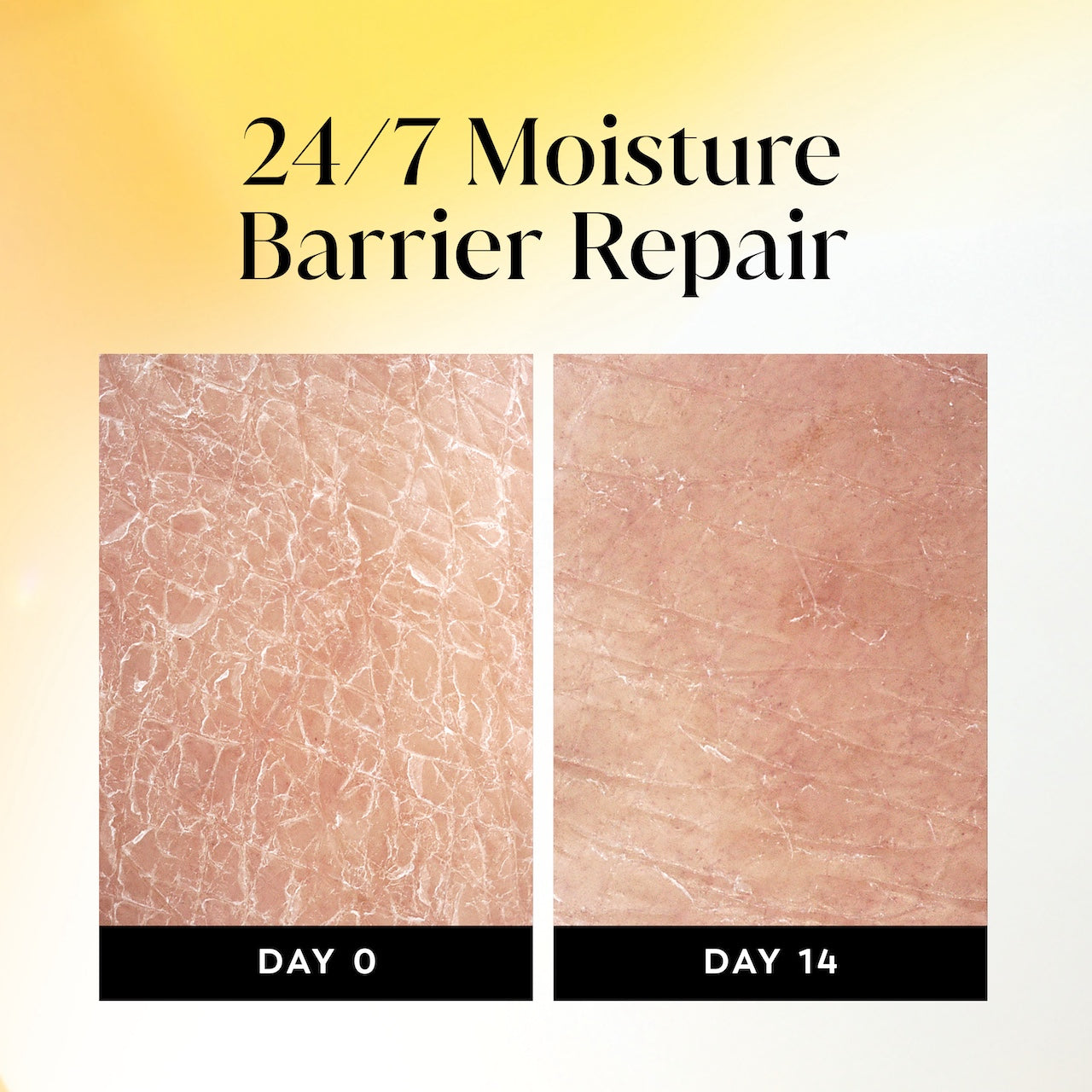 Before and after images using Olay Ultra Moisture Body Wash with Shea Butter, Vitamin B3 and Hyaluronic Blend from day 0 to day 14. 24/7 moisture repair barrier repair Before and after images using Olay Ultra Moisture Body Wash with Shea Butter, Vitamin B3 and Hyaluronic Blend from day 0 to day 14. 24/7 moisture repair barrier repair