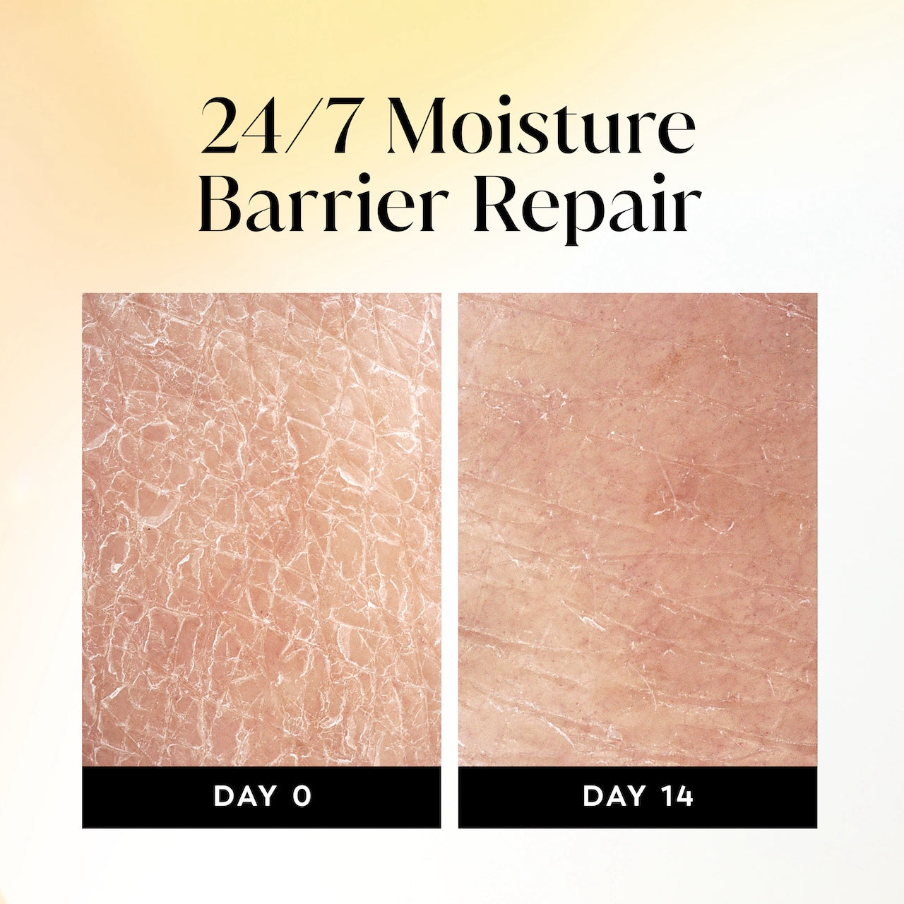 Before and after images using Olay Ultra Moisture Body Wash. Day 0 and day 14. 24/7 moisture barrier repair Before and after images using Olay Ultra Moisture Body Wash. Day 0 and day 14. 24/7 moisture barrier repair