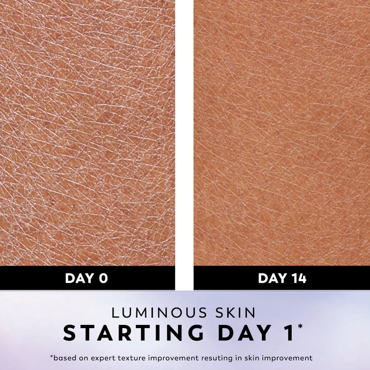 Before and after images of using uper Serum Body Wash for Extra Dry Skin, 20oz, Serum Complex for Luminous Skin day 0 and day 14. Luminous skin starting day 1*. *based on expert texture improvement resulting in skin improvement Before and after images of using uper Serum Body Wash for Extra Dry Skin, 20oz, Serum Complex for Luminous Skin day 0 and day 14. Luminous skin starting day 1*. *based on expert texture improvement resulting in skin improvement