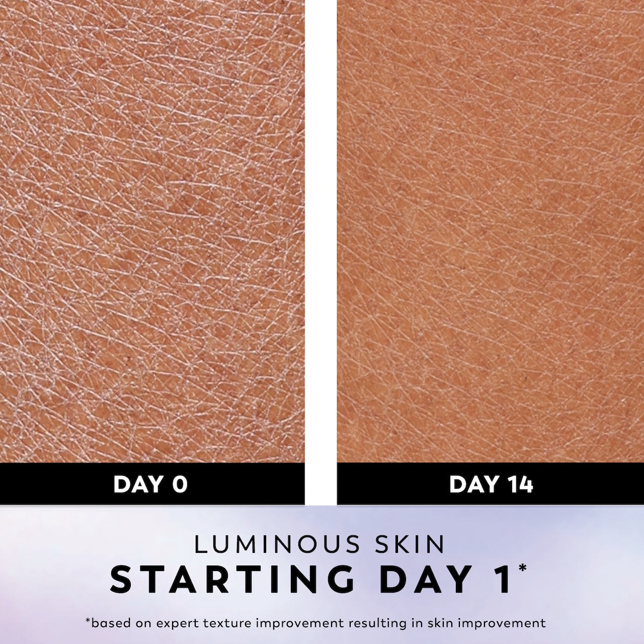 Before and after images of using uper Serum Body Wash for Normal Skin, 20oz, Serum Complex for Luminous Skin day 0 and day 14. Luminous skin starting day 1*. *based on expert texture improvement resulting in skin improvement Before and after images of using uper Serum Body Wash for Normal Skin, 20oz, Serum Complex for Luminous Skin day 0 and day 14. Luminous skin starting day 1*. *based on expert texture improvement resulting in skin improvement