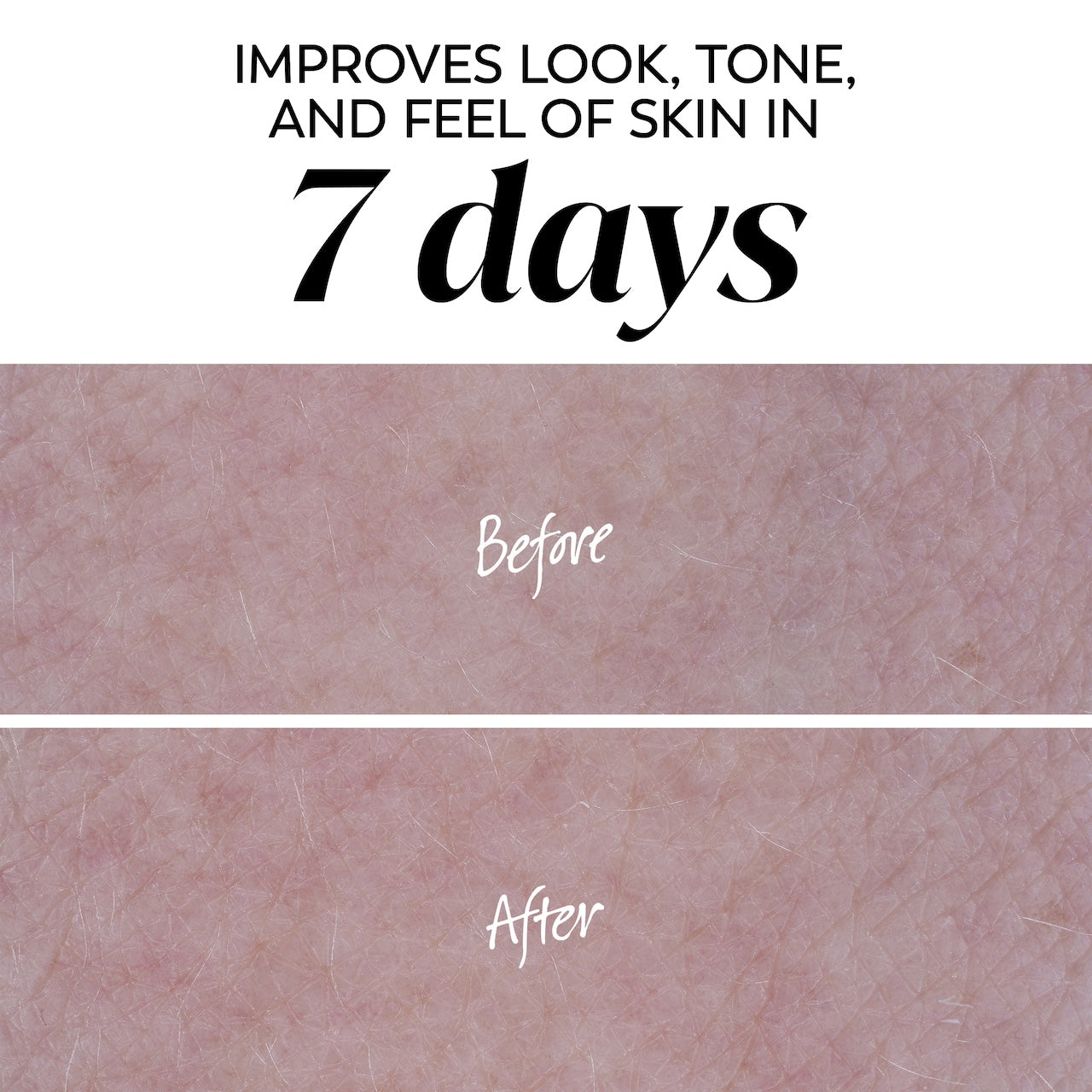 Before and after images of skin. Improves look, tone and feel of skin in 7 days.