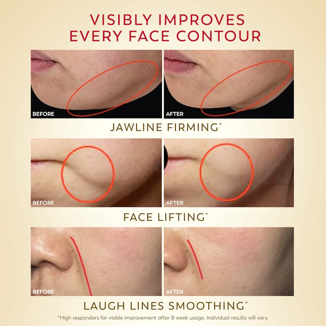 3 series of before and after images using OLAY Magic AA Soft Cream. Visibly improves every face contour. Jawline firming*, face lifting*, laugh lines smoothing*. *High responders for visible improvement after 8 week usage. Individual results will vary