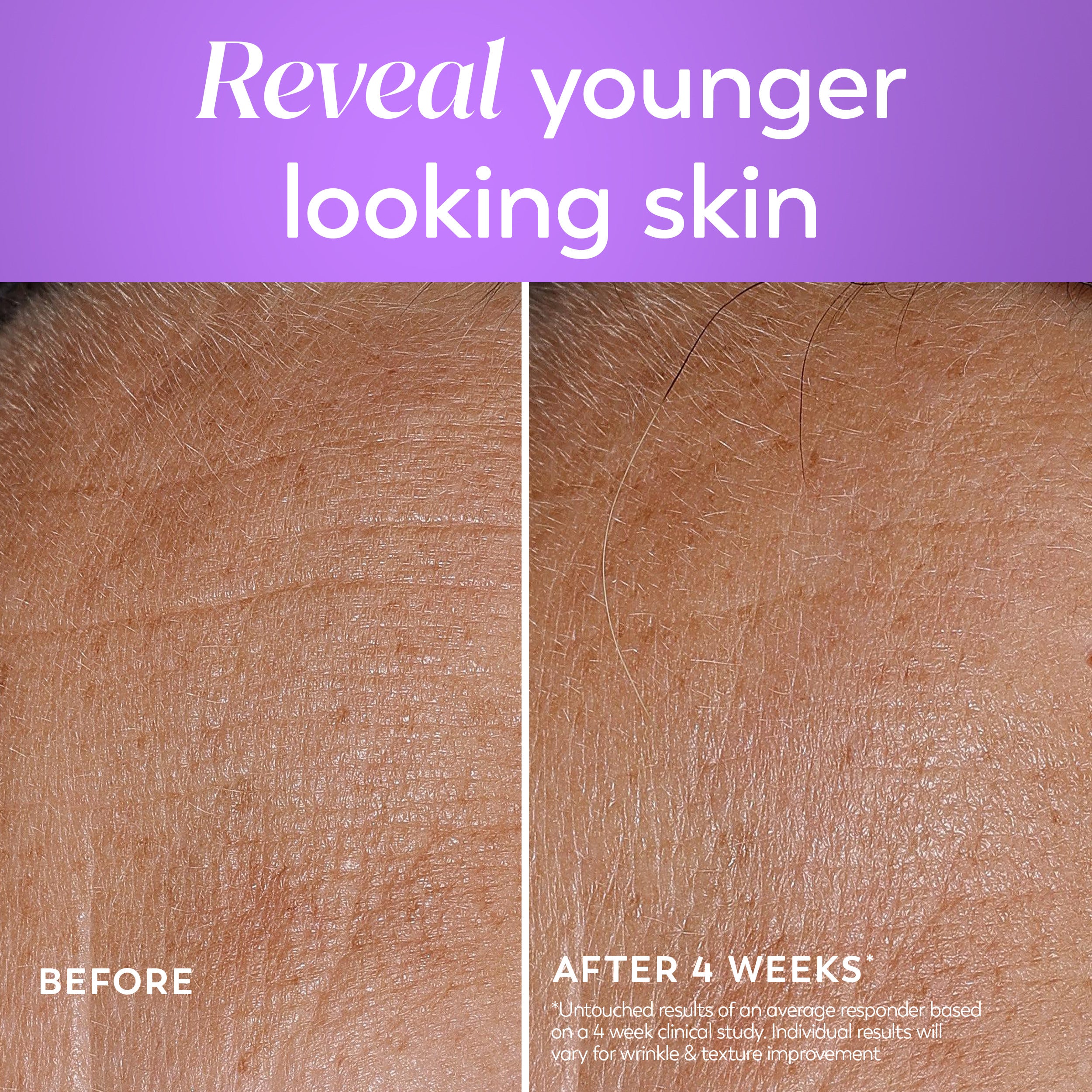 Regenerist Ret24 Starter Lotion