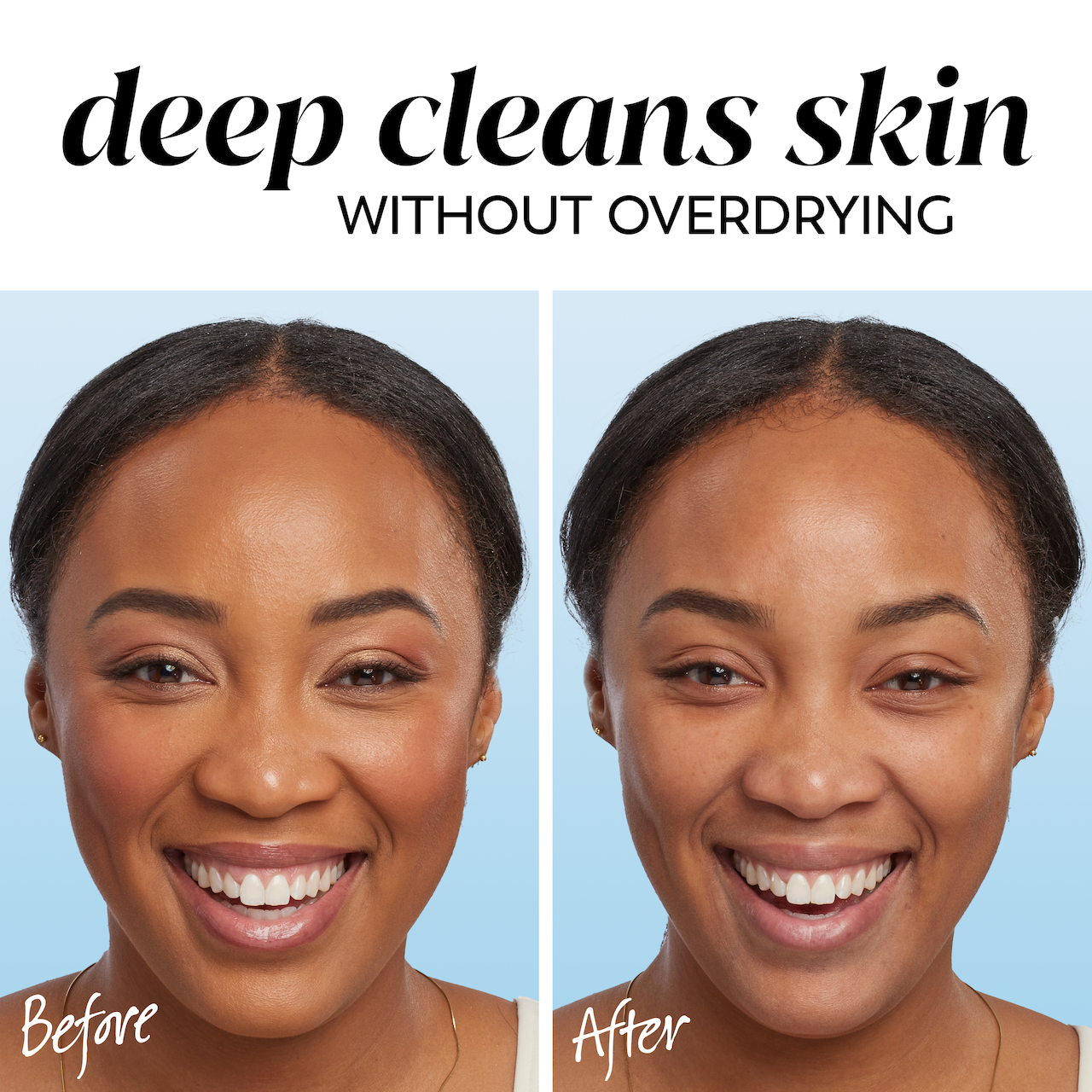 2 images model showing before and after. Deep cleans skin without over drying.