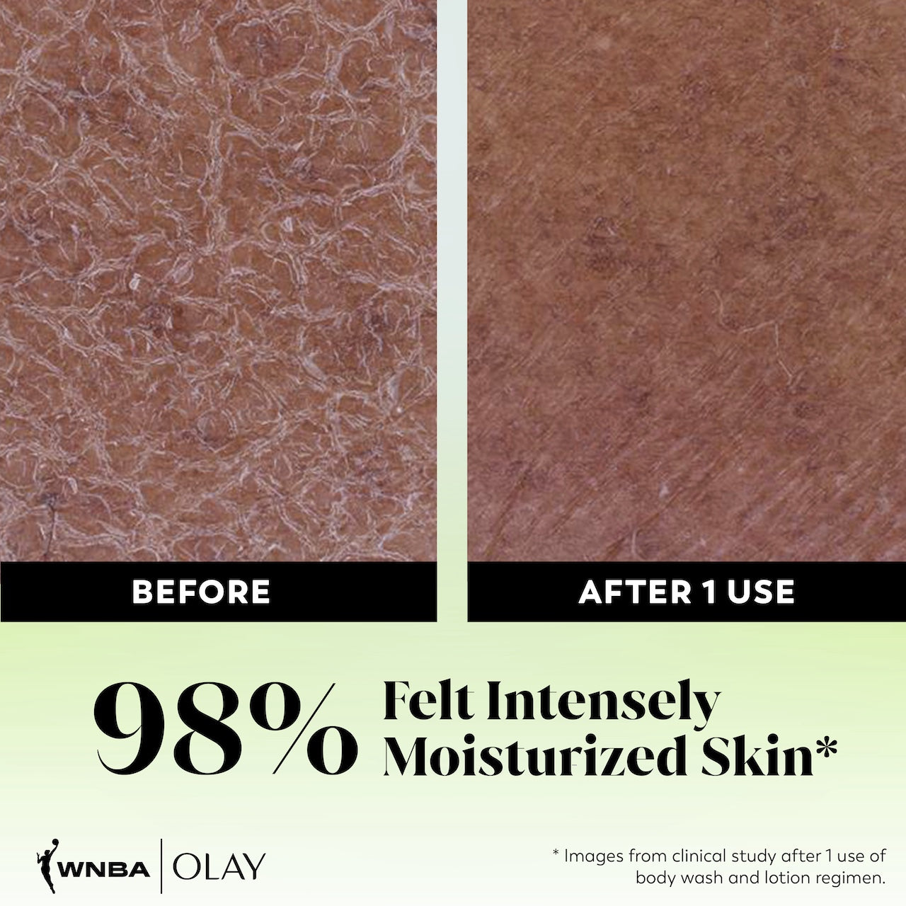 Before and after images showing Intensely Hydrating Body Wash after 1 use. 98% felt intensely moisturized skin*. *Images from clinical study after 1 use of body wash and lotion regimen