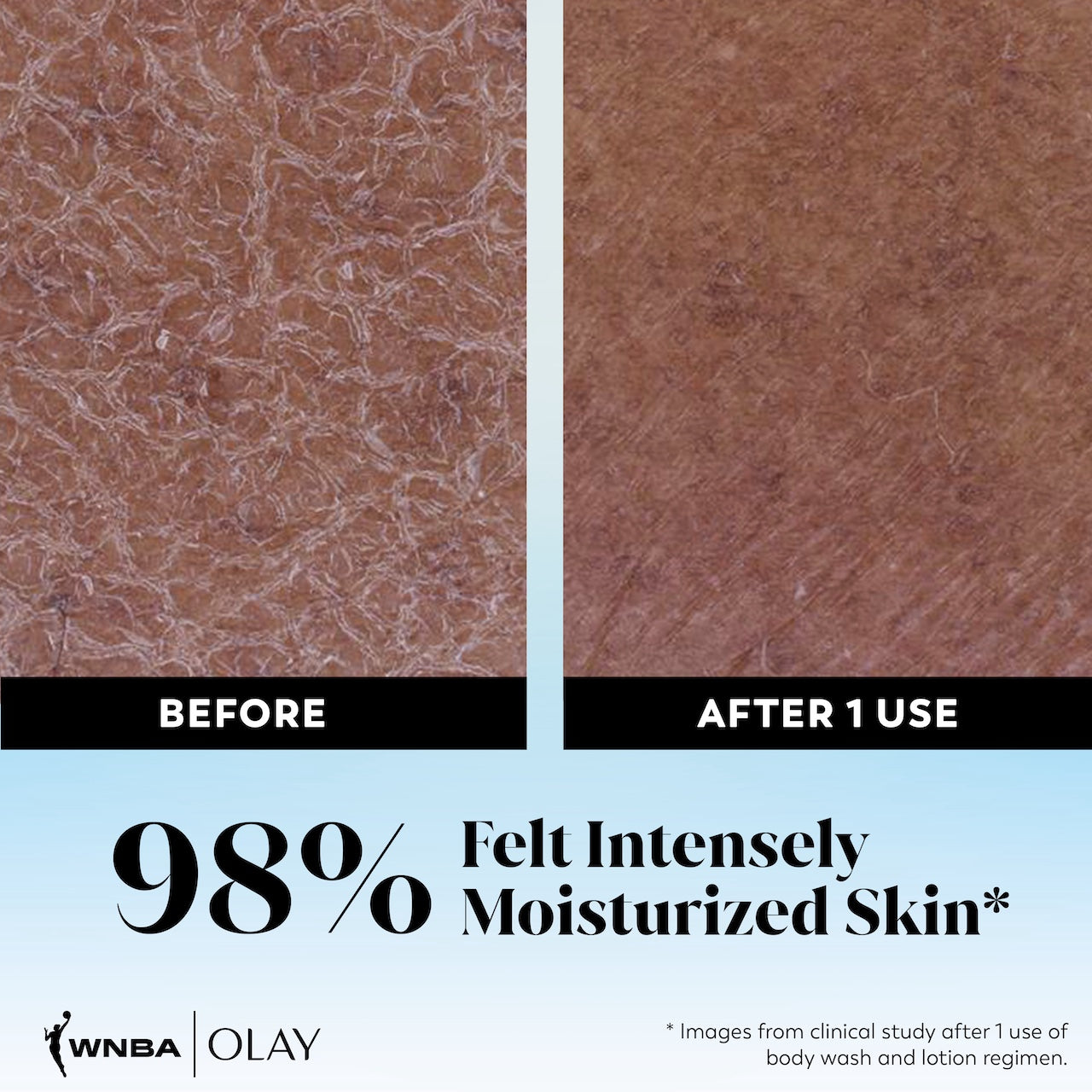 Before and after 1 use of Victory Vibes intensely Hydrating Body Wash. 98% felt intensely moisturized skin.* *images from clinical study after 1 use of body wash and lotion regimen