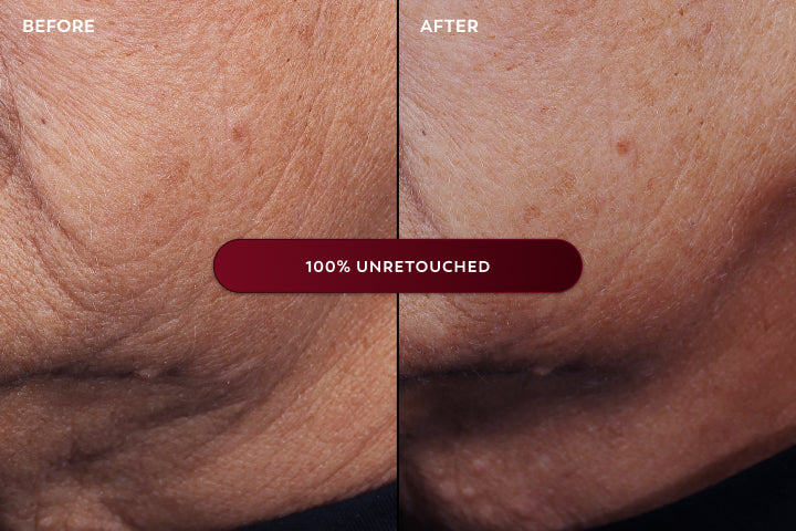 Before and after comparison of skin texture with a 100% unretouched label.