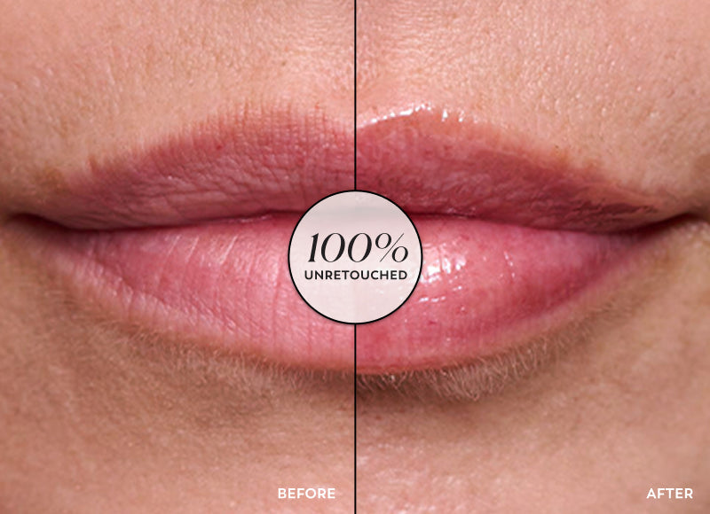 Before and after comparison of lips with a '100% Unretouched' label.