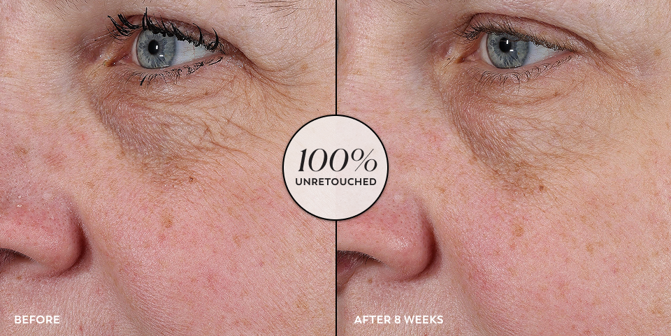 Before and after comparison of a person's eye with retouching applied.
