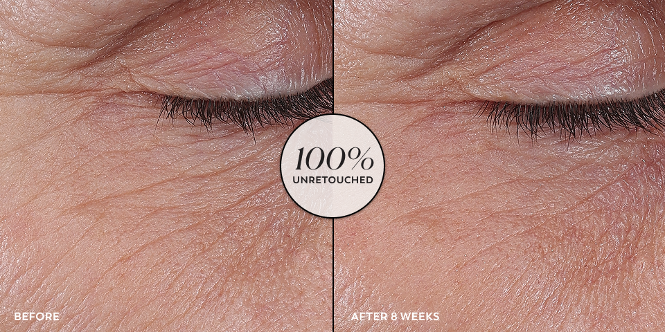 Before and after comparison of eye skin texture with a '100% Unretouched' label.