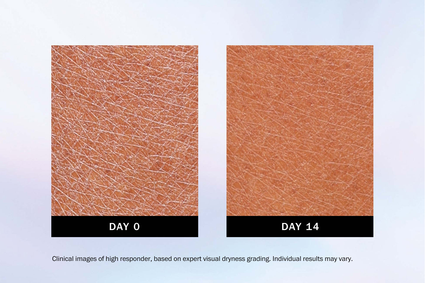 Before and after comparison of skin texture on Day 0 and Day 14 with a light blue gradient background.