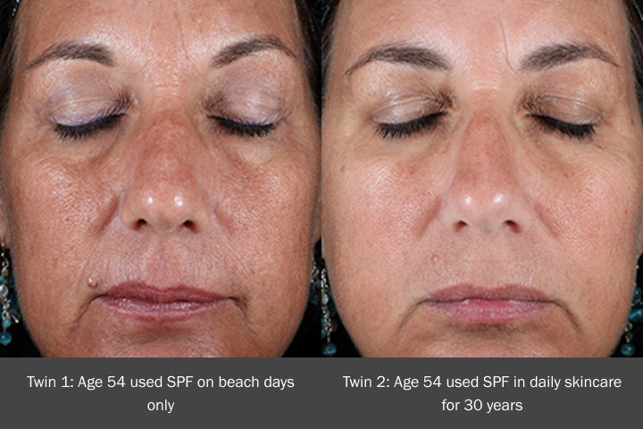 Side-by-side comparison of 54-year-old twins showing skin aging—left used SPF occasionally, right used SPF daily for 30 years